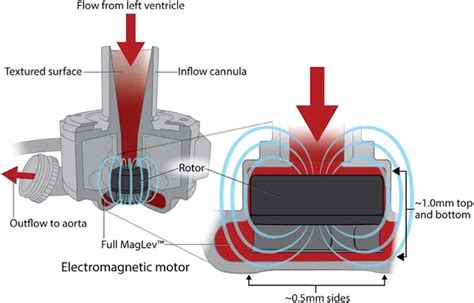 magnetically levitated centrifugal pump|magnetic circulatory pump.